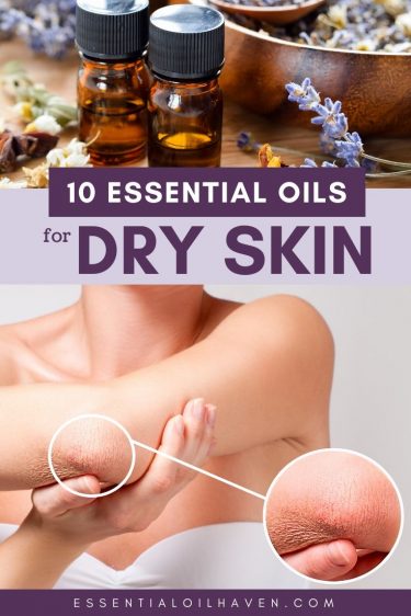 10 essential oils for dry skin