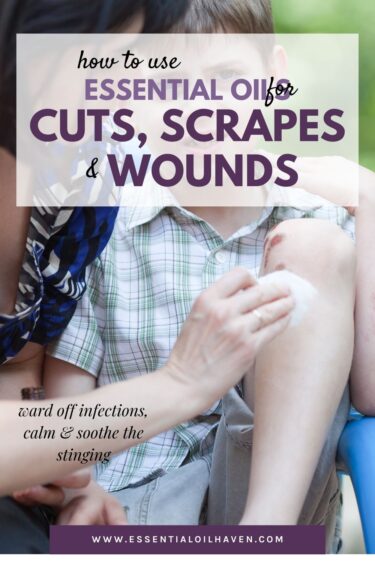 essential oils for wound healing