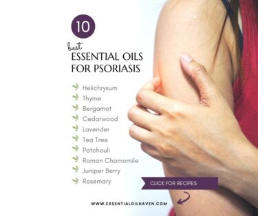 best essential oils for psoriasis