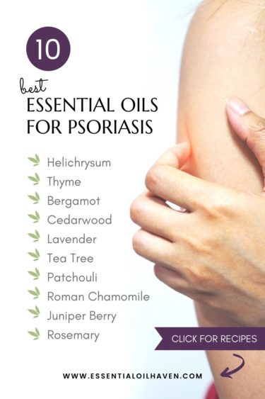 list of best essential oils for psoriasis