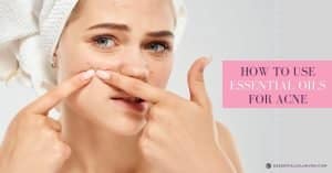 how to use essential oils for acne