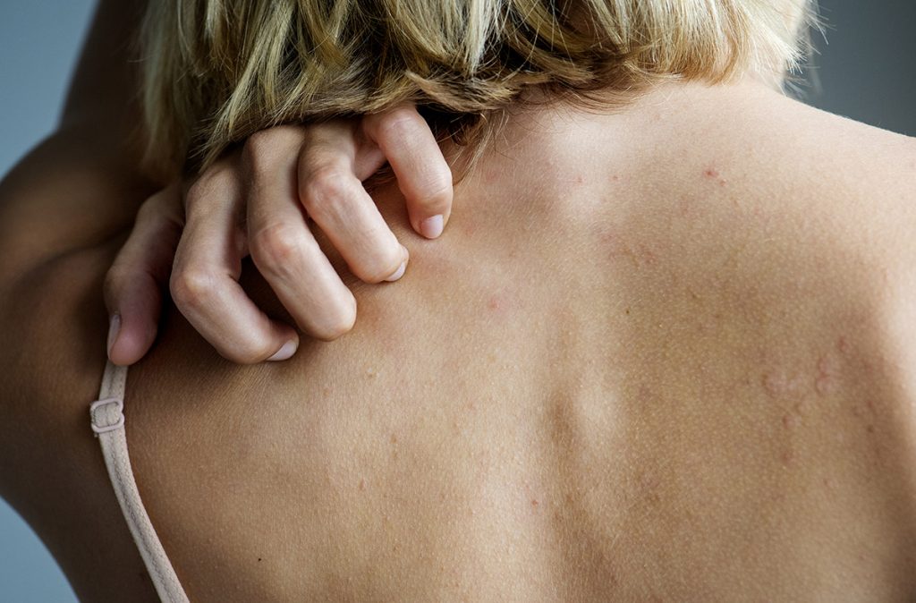 itchy skin from essential oils application