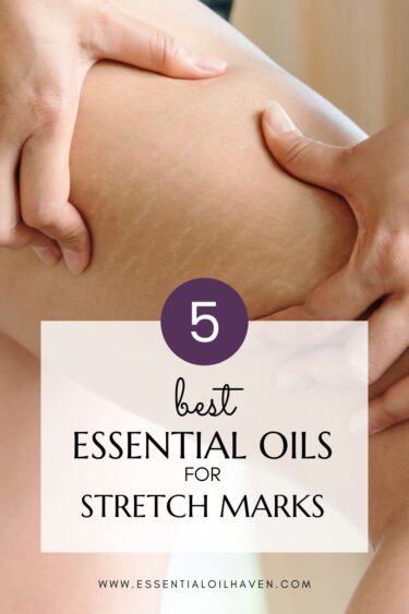 best essential oils for stretch marks