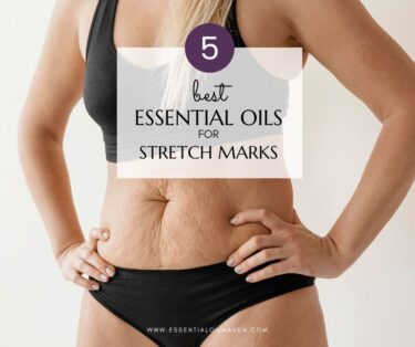 best essential oil for stretch marks