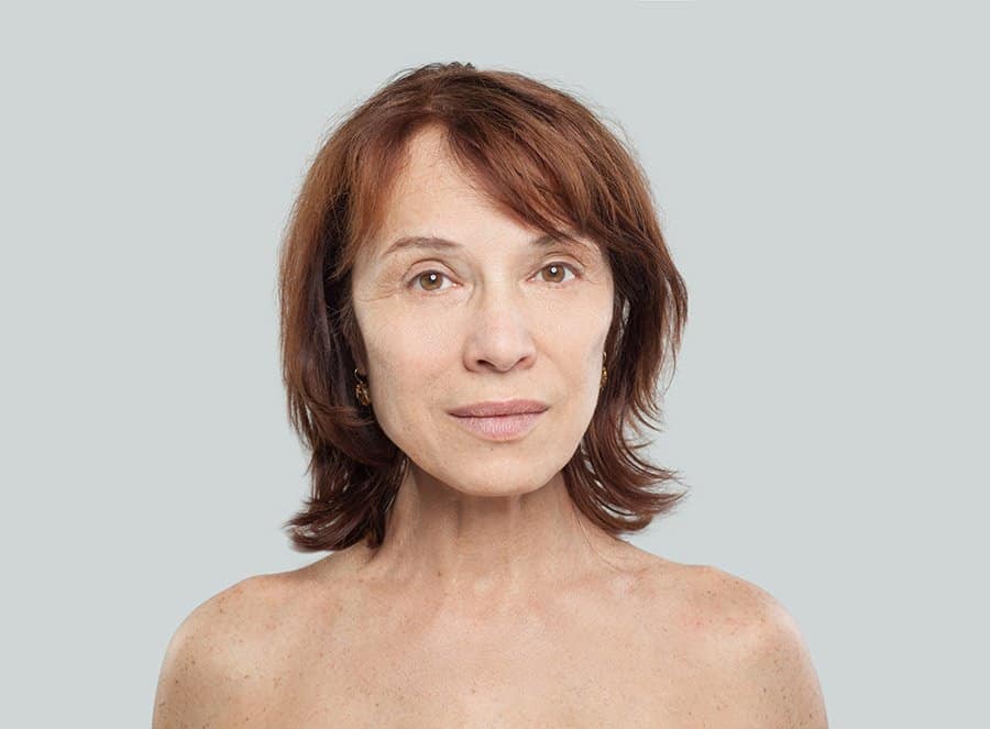 woman with face wrinkles