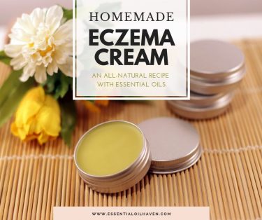 eczema cream