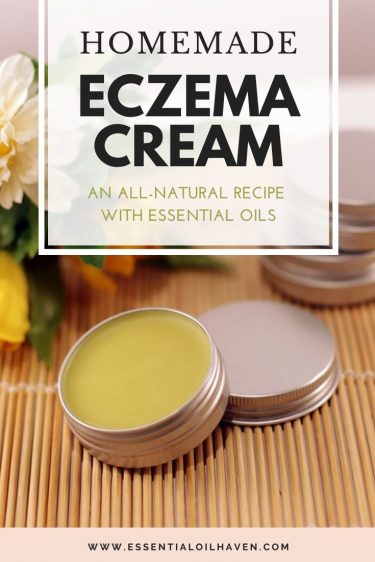 diy eczema cream recipe