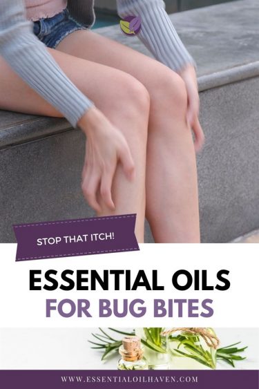 best essential oils for bug bites