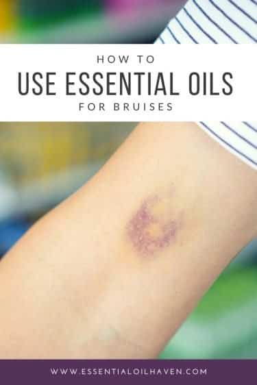 essential oils for bruised body parts