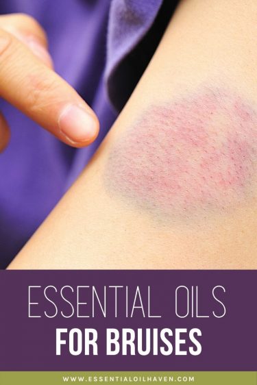 essential oils for bruises
