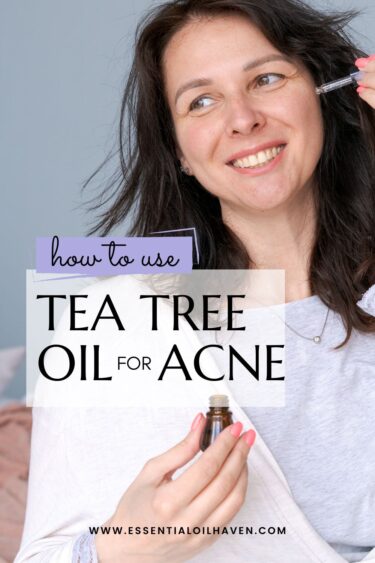 tea tree oil for acne