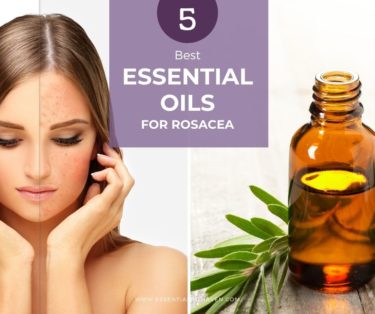 oils for rosacea