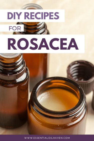 recipes for rosacea with essential oils