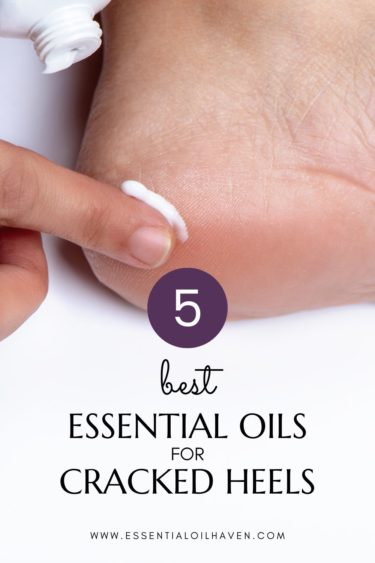 essential oils for cracked skin on heels and feet