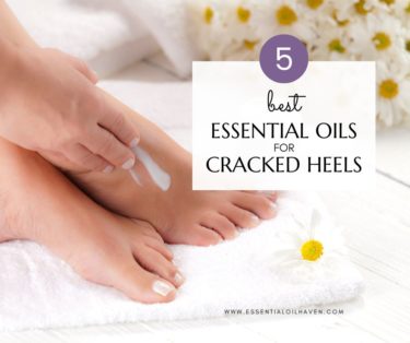 essential oils for cracked feet